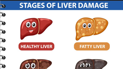 Andrej Medveď - Stukovatená pečeň nie je len "trocha tuku v pečeni" . Je to výsledok narušeného metabolizmu a zápalový proces, ktorý v pečeni prebieha. Následky neriešenia sú pre ľudí niekedy fatálne. 