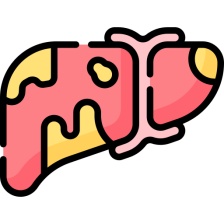 - Stukovatená pečeň